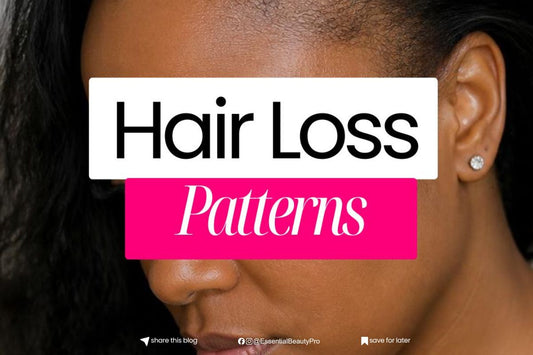 Hair Loss Patterns: What Is Your Hair Trying to Tell You?